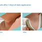 Stelatopia intense eczema relief